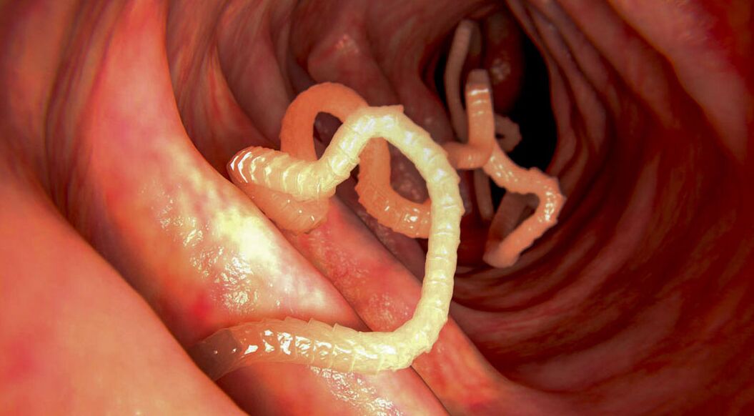parasitoen diagnostikoa hesteetan