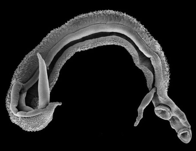 giza gorputzeko esquistosoma