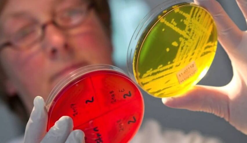 Parasitoen diagnostikoa giza gorputzean