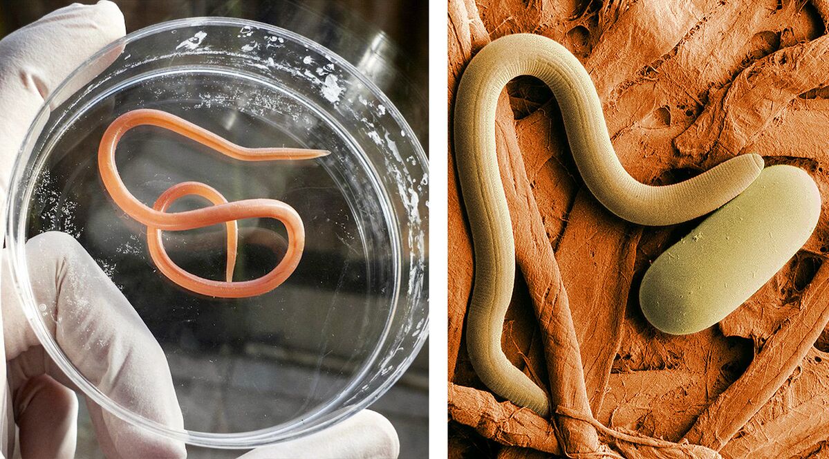 parasitoak giza gorputzean