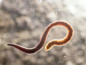 gizakien harra parasitoa
