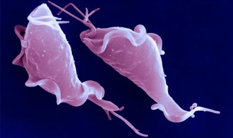 Trichomonas vaginalis antzutasuna eragiten duen protozoo parasitoa da.